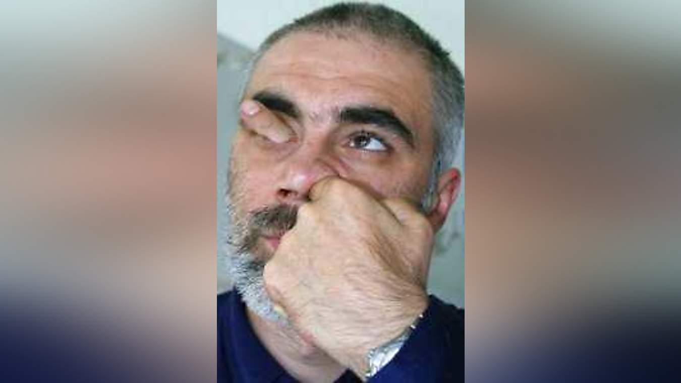 fda-warns-of-the-dangers-of-excessive-nose-picking-the-spoof